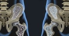 biology behind osteoporosis revealed in new study 4