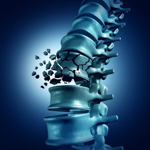 Biology Behind Osteoporosis Revealed in New Study